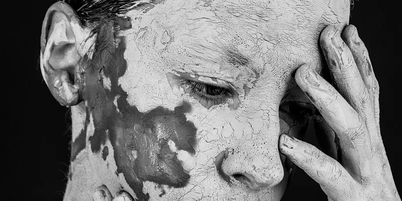 Vitiligo Site For Sell Template vitiligo site for sell template