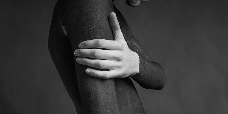 Stretch Marks Background stretch marks background